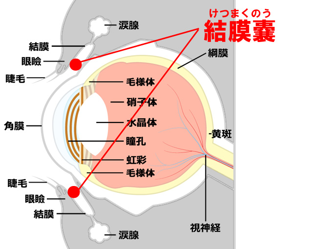  結膜嚢 けつまくのう