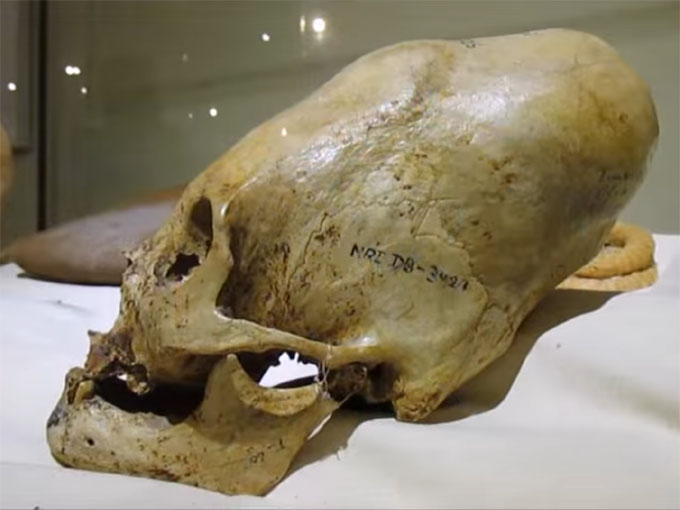 ペルーで発見されたパラカスの長頭頭蓋骨